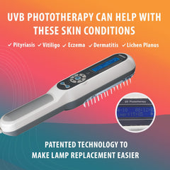 Corded UV 311nm Narrow Band Phototherapy Light by Brightwand, Light Therapy with Timer Control, Home Use with Goggles, UV/311nm – Medical Grade Philips Bulb. Treats a variety of skin conditions